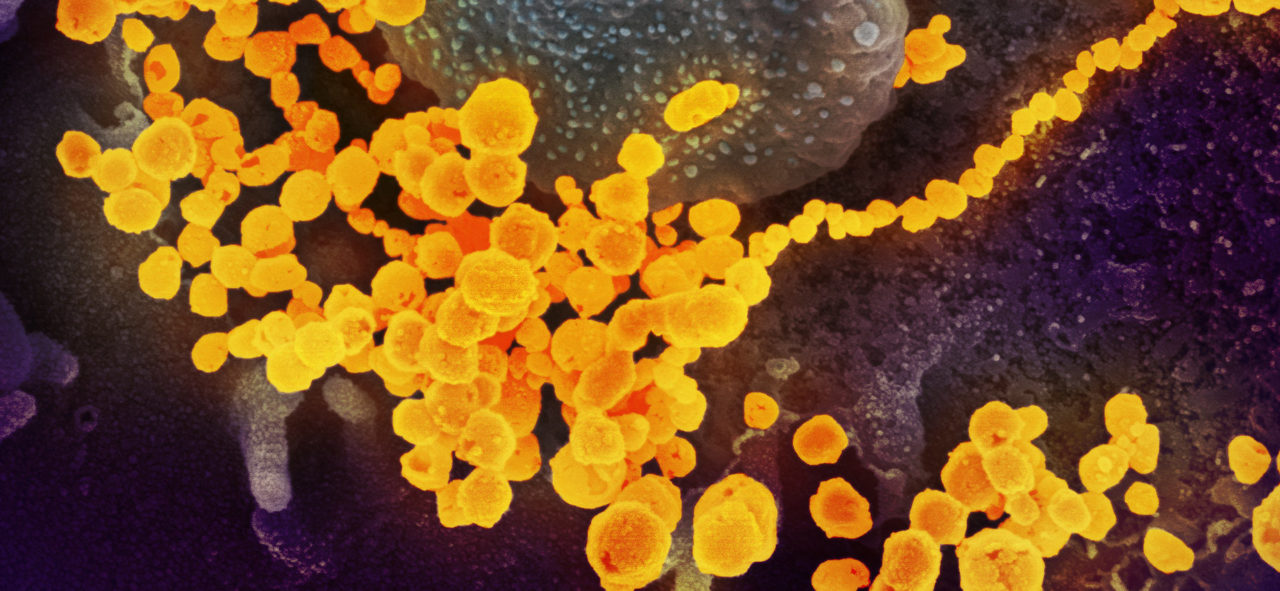 Coronavirus SARS-CoV-2 (Credit NIAID-RML usage libre)