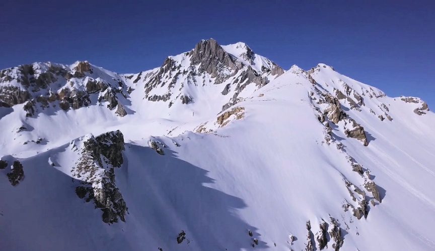 Dent Parrachée